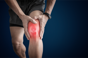 Arthritis